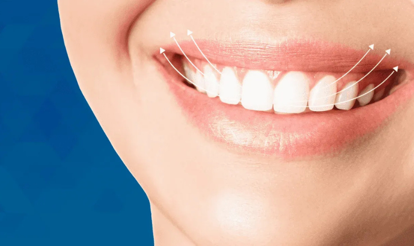 How Digital Smile Design is Changing Cosmetic Dentistry Forever